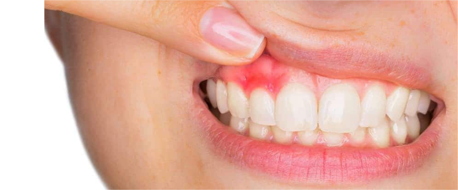 Arely_dientes 02